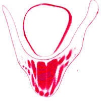 X-378