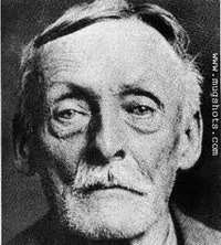 Albert Fish 