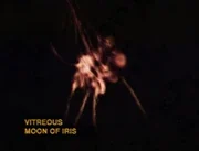 vitreous