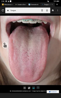 Tongue