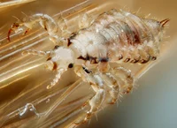Head Louse