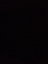 pneumonoultramicrosc