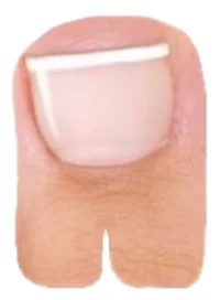 Toemongus