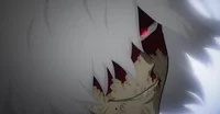 1Tomura Shigaraki VI
