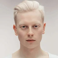 Albino Dude