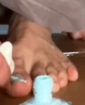 Benoftheweeks toes