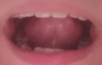 Mouth