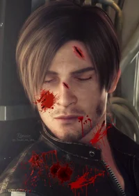 Injured Leon Kennedy