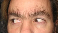 Eyebrow Hair