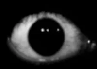 Eyes