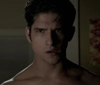 Scott McCall 