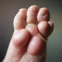 paw parasite 2