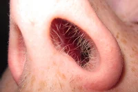nostril hair