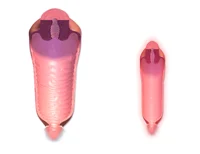 Vaginal area surgery