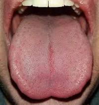 Tongue