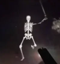Normal Skeleton
