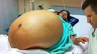Woman Big Pregnant 