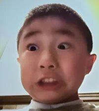 Angry seperated twin