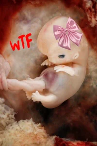 Unborn fetus TG