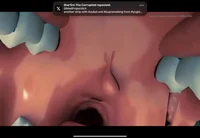 Changing hng history