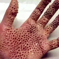 Trypophobia virus