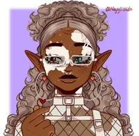 Vitiligo Elf