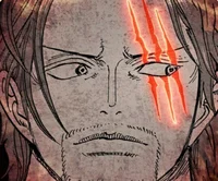 Shanks