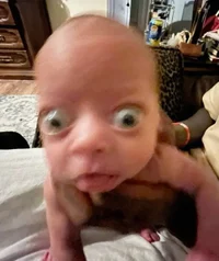 Ugly baby