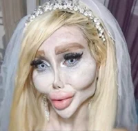 plastic surgery