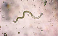 Parasite