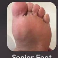 Senior Feet