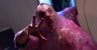 Blob victim 