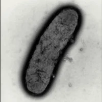 Yers Pestis B Plague