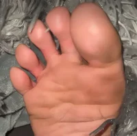 Sensitive Feet 1