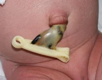 Umbilical cord