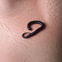 Skin worm