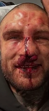 Alex Terrible -2025-