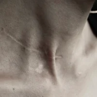 REMUS L