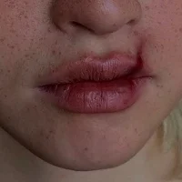 aos
