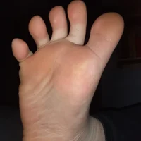 MY Foot