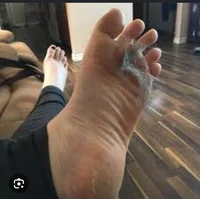 Filthy feet