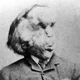 Joseph Merrick