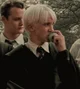 Draco malformation 