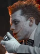 Jerome Valeska 