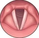 Bodiepoos vocal cord