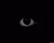 Black Eye Eye