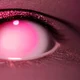 Pink Eye