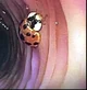 Colon ladybug 