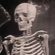 Bones 