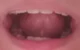 Mouth